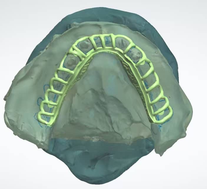 Digital dentistry workflow